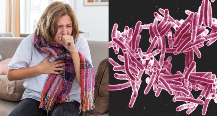 Tuberculosis vuelve a ser la principal amenaza sanitaria en el mundo
