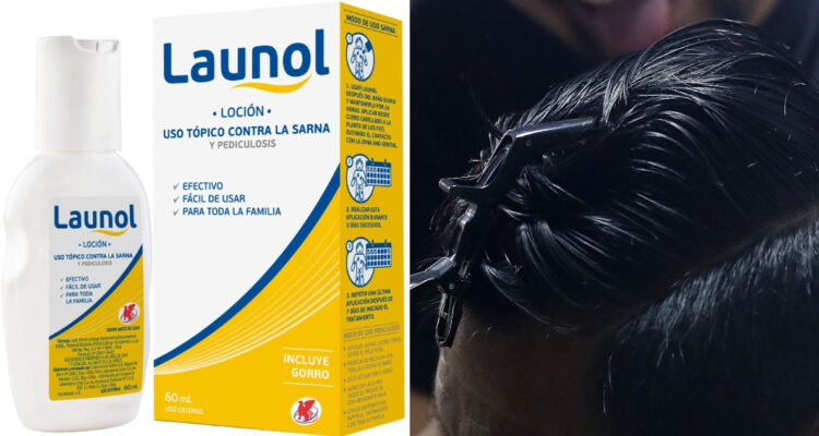 ISP emite alerta por medicamento para el tratamiento de piojos: fabricante inició retiro voluntario