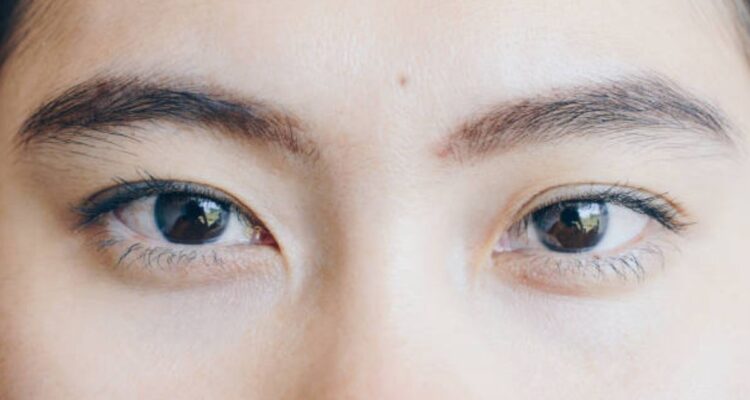 Qué es la blefaroplastia y por qué es controvertida en Japón