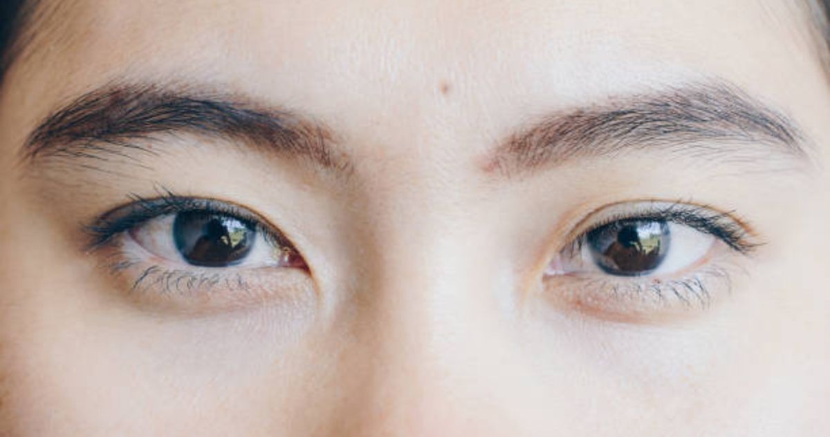 Qué es la blefaroplastia y por qué es controvertida en Japón