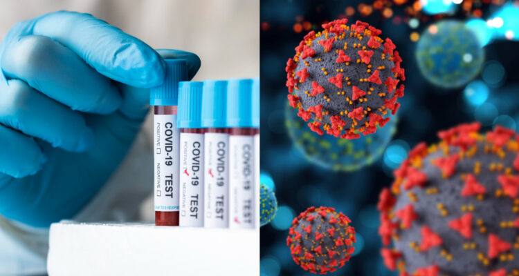 Científicos identifican nueva proteína del coronavirus