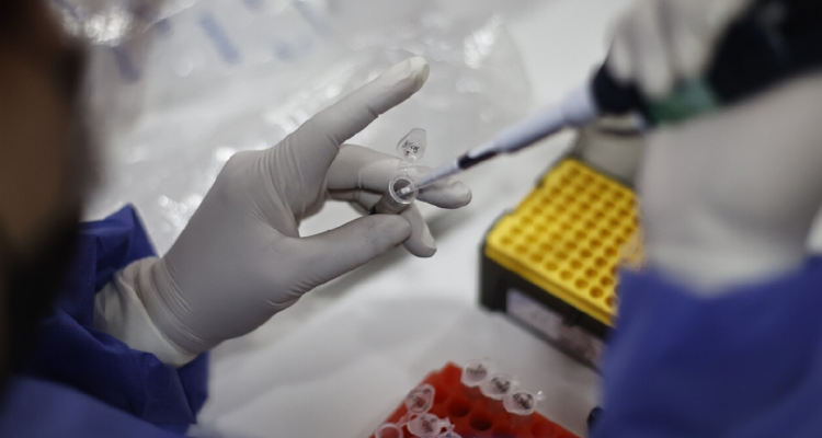 Confirman el segundo fallecimiento por viruela del mono en Chile