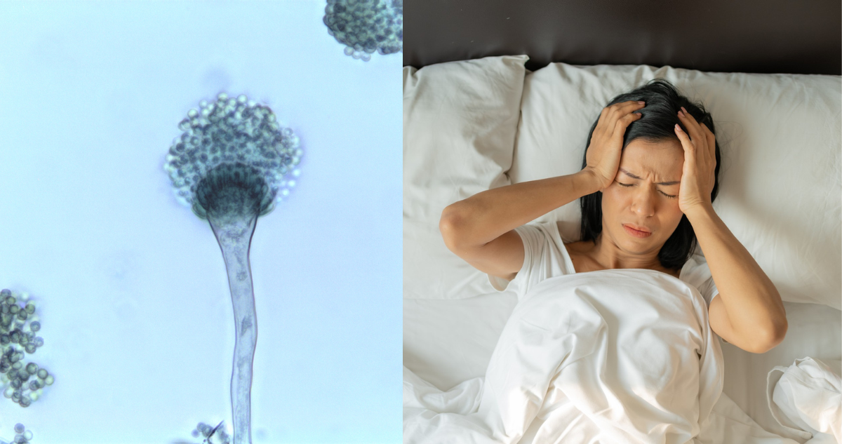 Fotografía del hongo Aspergillus fumigatus, uno de los hongos más peligrosos (izquierda) y una mujer con dolor de cabeza, uno de los síntomas de la meningitis (derecha)
