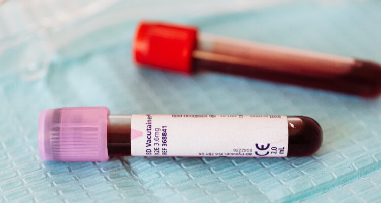 Descubren biomarcador que detecta el cáncer de colo temprano