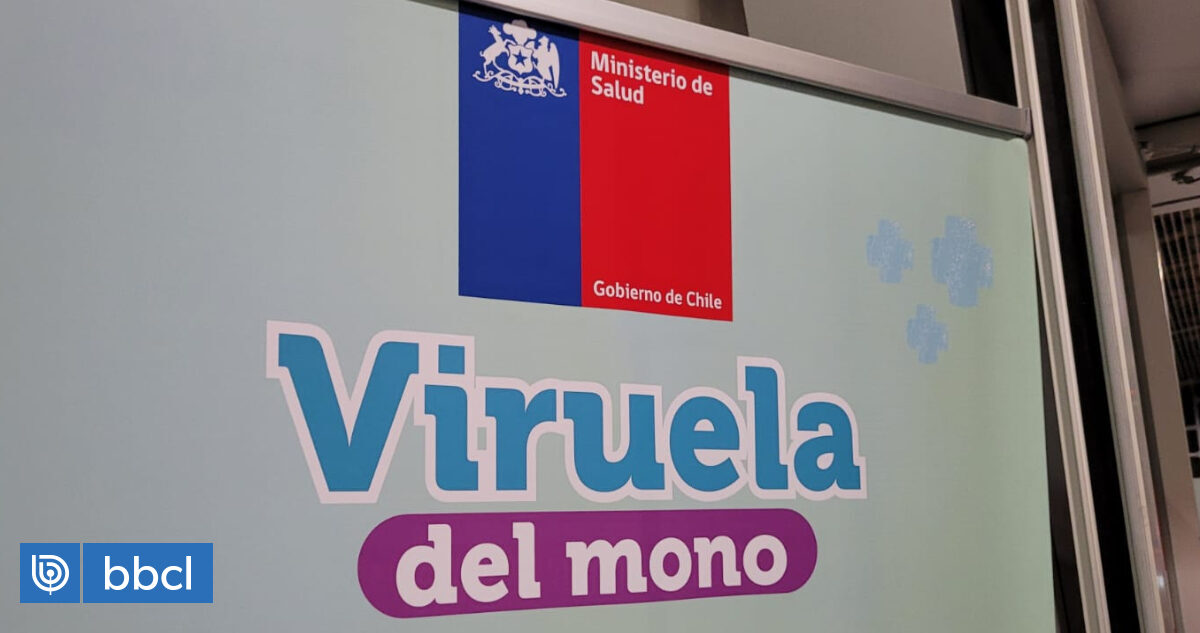 Minsal reporta primera muerte por viruela del mono en Chile |  nacionales