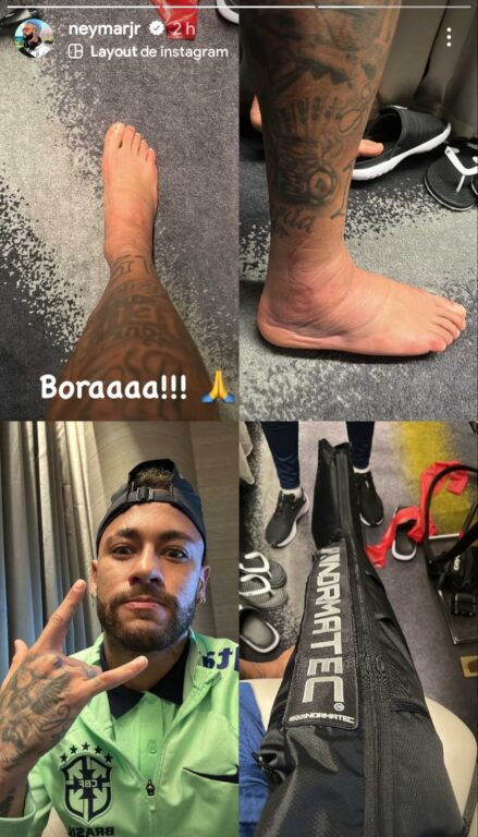 Neymar muestra como está su tobillo.