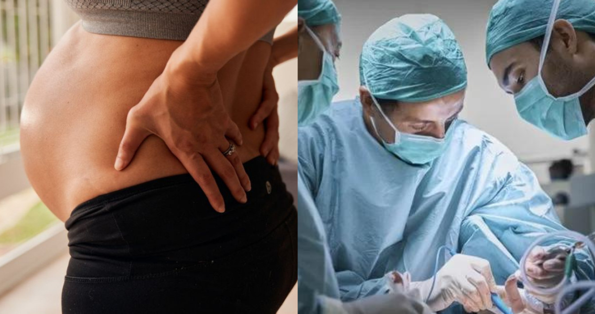 Remueven tumor de 70 kilos