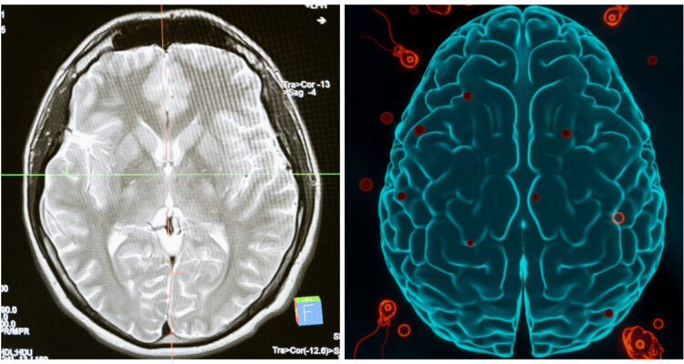 Primer fallecido por “ameba comecerebros” en Corea del Sur