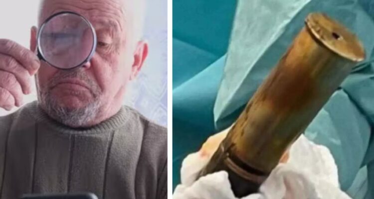 Un hombre de 88 años llegó con un proyectil de la Primera Guerra Mundial en su ano, lo que obligó a evacuar un hospital en Francia