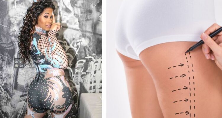 Qué son las inyecciones de biopolímeros: La cirugía de la que Cardi B se arrepiente