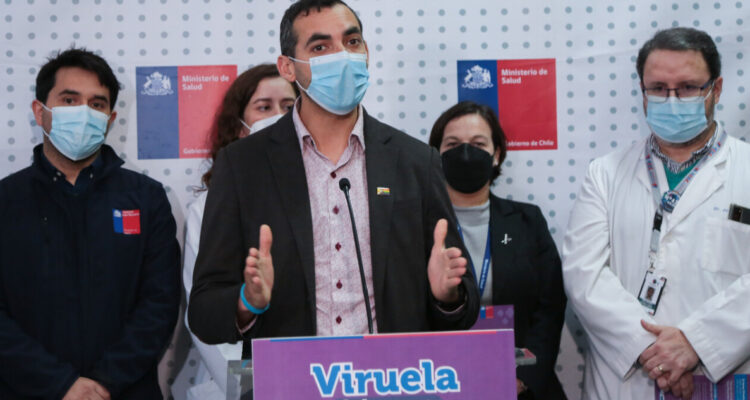 Pauta Minsal por viruela del mono