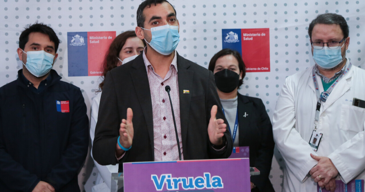 Pauta Minsal por viruela del mono