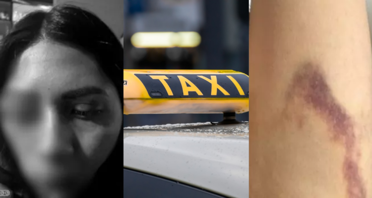 Mujer denuncia que taxista intentó abusar de ella y la golpeó