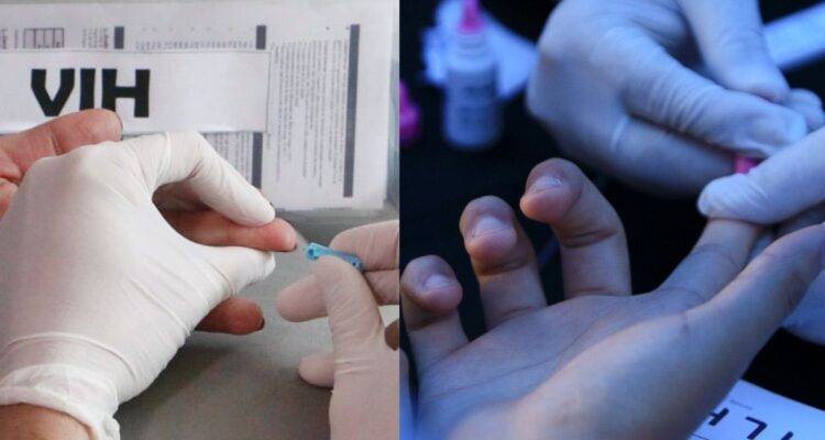 VIH/Sida: Comisión de Salud solicitará a Minsal actualización de cifras por contagios y muertes