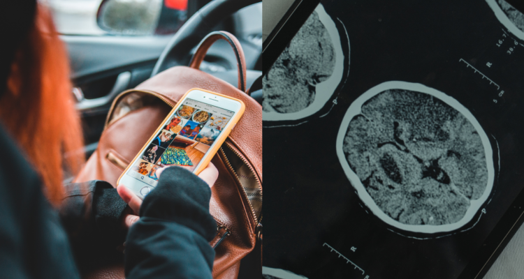 Adolescente usando su celular dentro de un auto(izquierda) y radiografía de un cerebro (derecha). redes sociales respuestas cerebrales