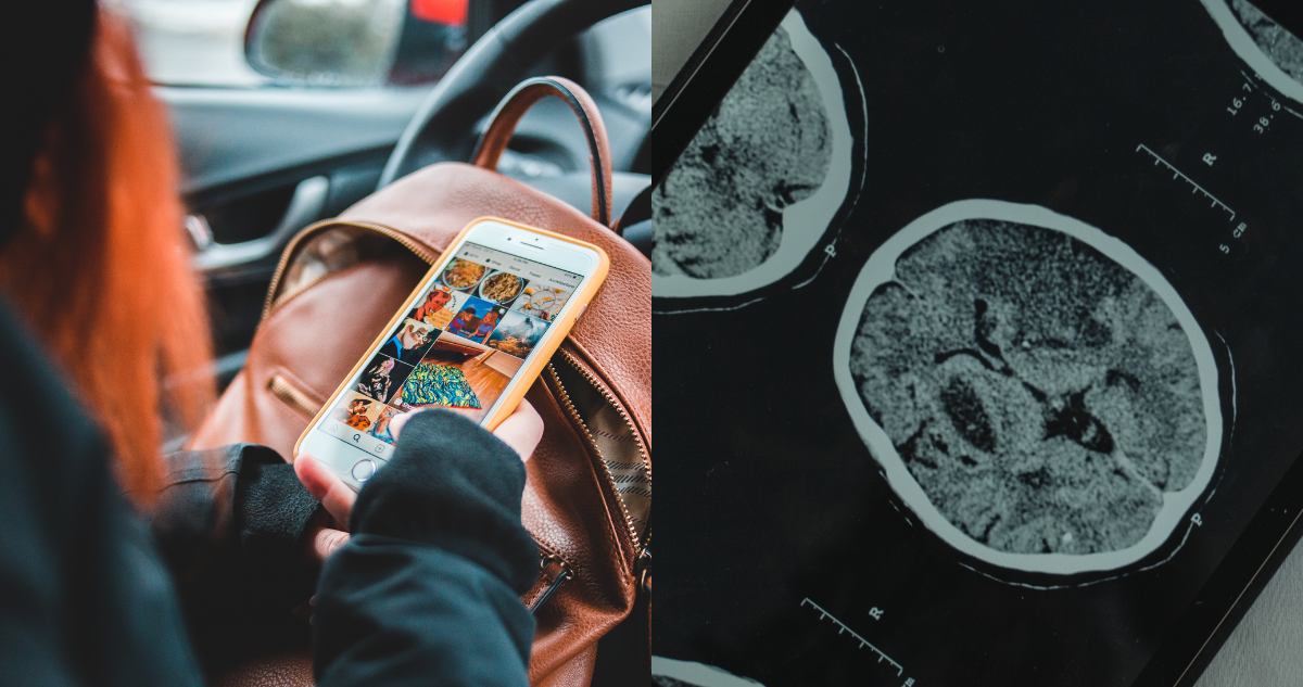 Adolescente usando su celular dentro de un auto(izquierda) y radiografía de un cerebro (derecha). redes sociales respuestas cerebrales