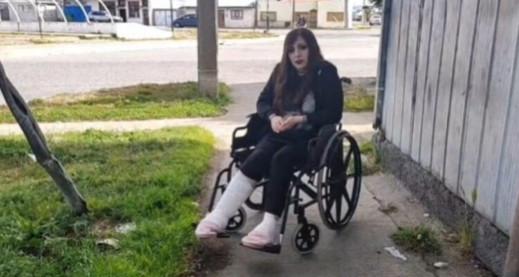 Le operaron pierna equivocada: Mujer denuncia grave error en Hospital Clínico de Magallanes