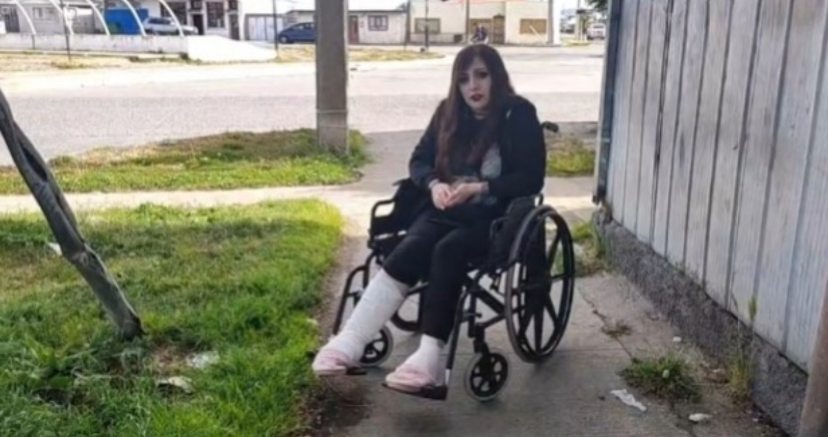 Le operaron pierna equivocada: Mujer denuncia grave error en Hospital Clínico de Magallanes