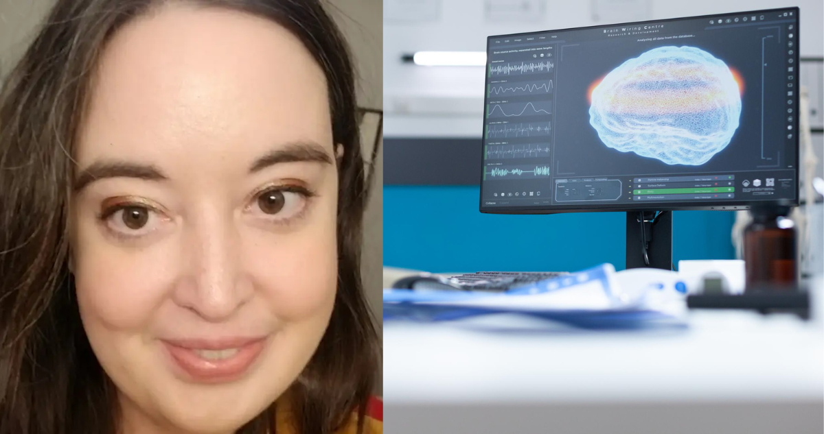 Meghan Beaudry (izquierda) paciente de Lupus que cambió su personalidad por inflamación de su cerebro (derecha)