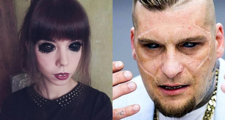 Aleksandra Sadowska quedó ciega