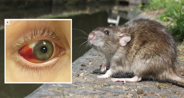 El estremecedor caso de ojos inyectados de sangre: joven cayó a canal con orina de ratones