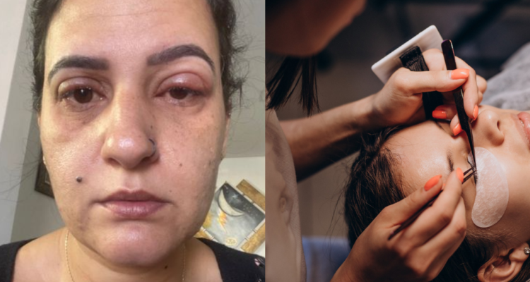 Valéria Campos, mujer que terminó en urgencias por reacción alérgica a extensiones de pestañas (izquierda) y fotografía de referencia de uno de estos procedimientos (derecha)