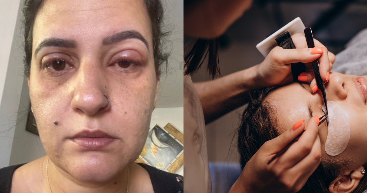 Valéria Campos, mujer que terminó en urgencias por reacción alérgica a extensiones de pestañas (izquierda) y fotografía de referencia de uno de estos procedimientos (derecha)