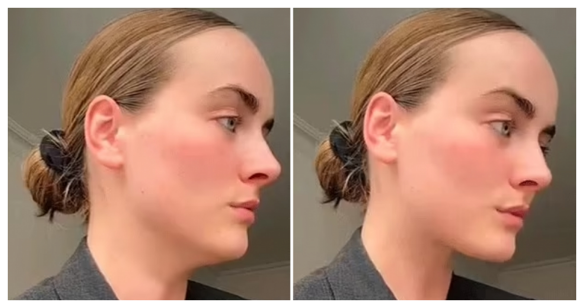 Mewing: La técnica viral para afilar tu rostro sin cirugía y