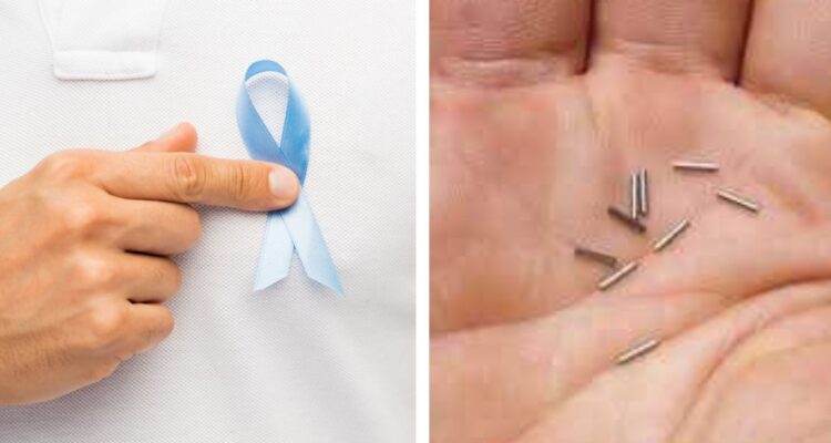 braquiterapia, las semillas radioactivas contra el cáncer de próstata que está incluído en el GES
