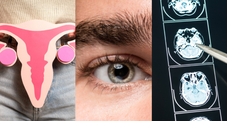 Mujer con ilustración de un útero (izquierda), ojo de un hombre (centro) y radiografía de un cerebro (derecha), esto en referencia a zonas desconocidas del cuerpo que son afectadas por el Covid