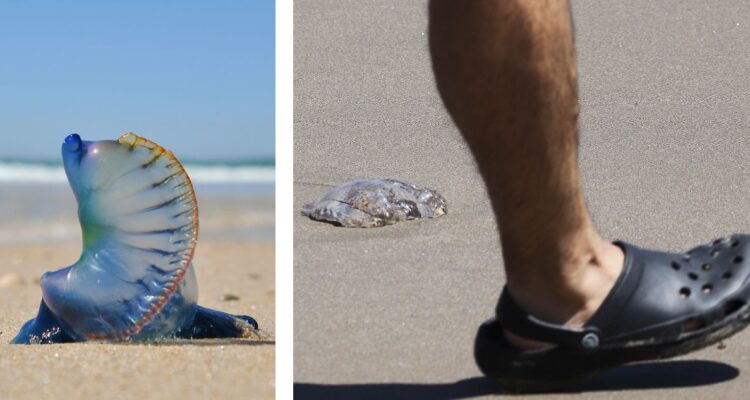 Qué es la fragata portuguesa y qué hacer en caso de una picadura ¿cuáles son sus síntomas y riesgos?