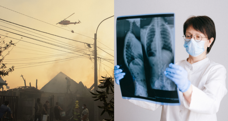 Incendio forestal en Chillán (izquierda) y una mujer observando una radiografía de pulmones, sistema respiratorio (derecha)
