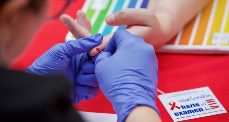 30% de los test de VIH en la RM han sido positivos