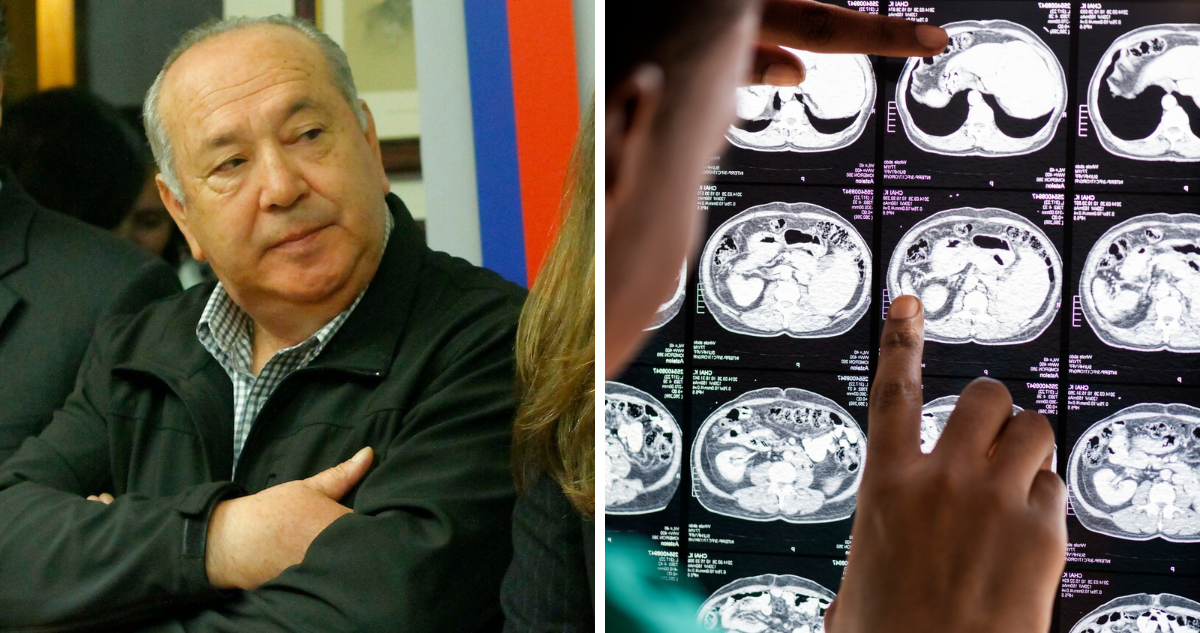 Alipio Vera (izquierda) y fotografía de una radiografía cerebral (derecha) a propósito del accidente vascular isquémico que lo afectó