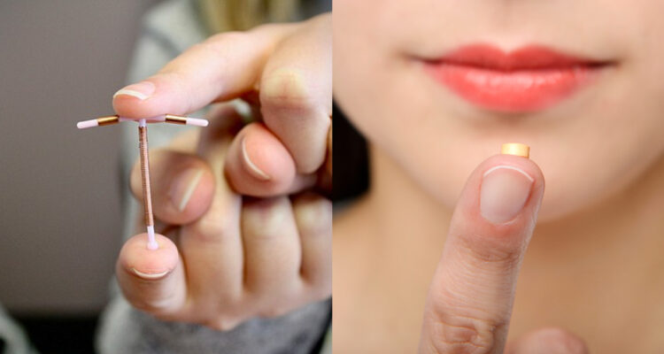 Dos tipos diferentes de anticonceptivos hormonales. De acuerdo a un estudio, este tipo de métodos aumentaría el riesgo de cáncer de mamas.