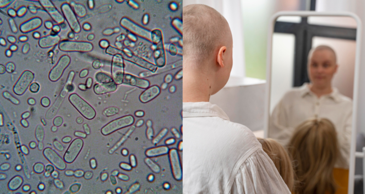 Ilustración de bacterias (izquierda) y una mujer con cáncer frente a un espejo (derecha)