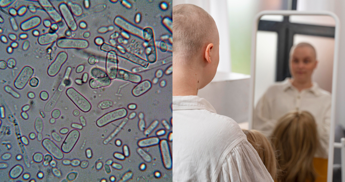 Ilustración de bacterias (izquierda) y una mujer con cáncer frente a un espejo (derecha)