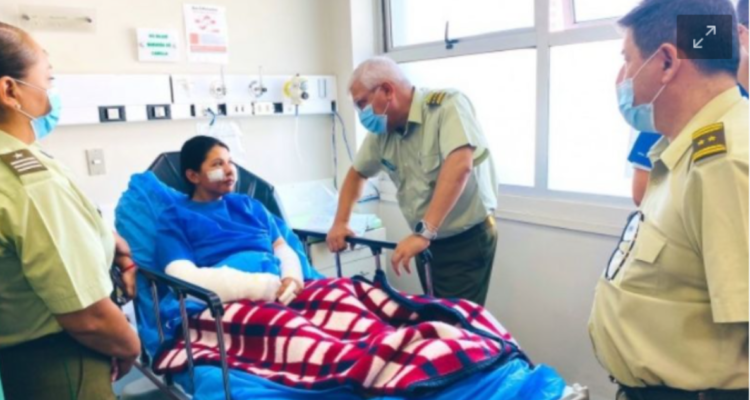 carabinera resulta con quemaduras