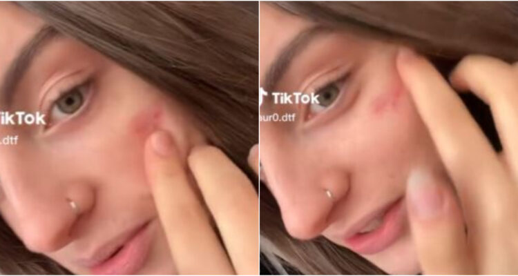 TIKTOKER QUE SE UNIÓ A CICATRIZ FRANCESA