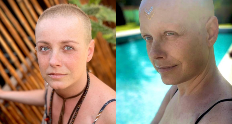 Claudia Conserva cáncer