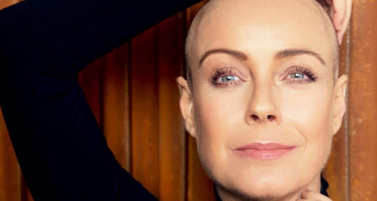 La animadora de televisión Claudia Conserva posa sonriente en una foto donde aparece rapada.