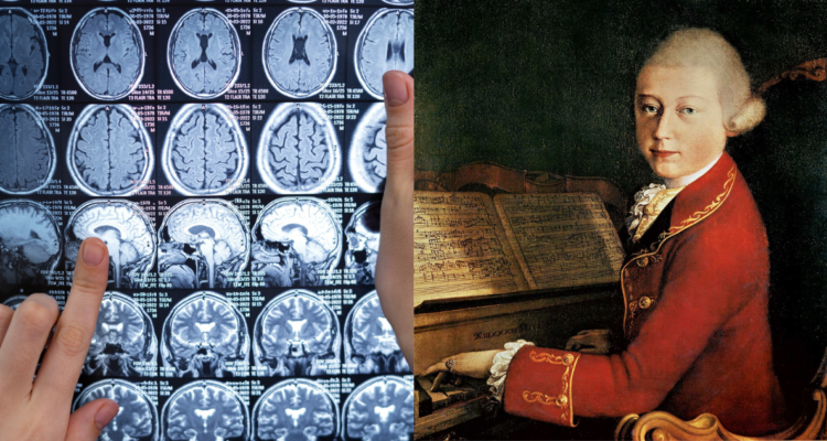 Radiografía cerebral (izquierda) y una antigua pintura de Mozart (derecha) en referencia a estudio que desmiente el “Efecto Mozart”