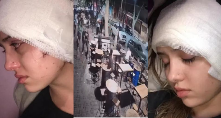 Garzona atacada en bar argentino