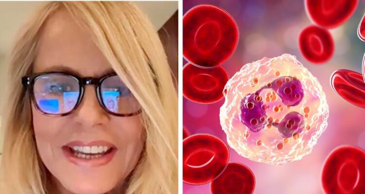Qué es la neutropenia, la enfermedad de Cecilia Bolocco: cuáles son sus síntomas y cómo se contagia