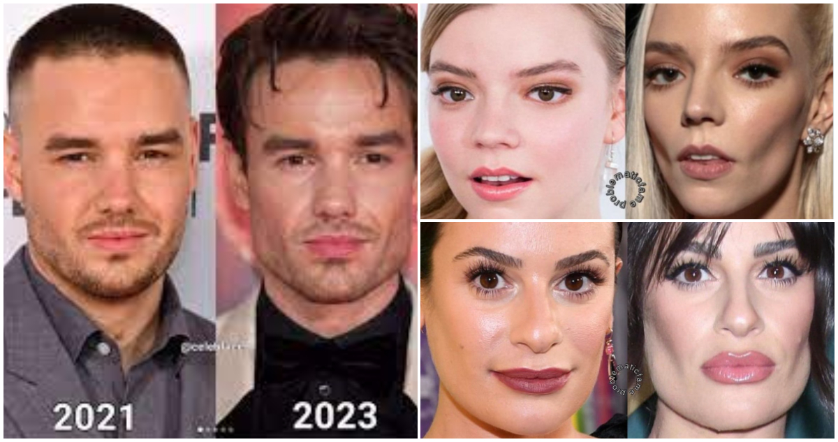 ACTORES QUE SE SOMETIERON A UNA bichectomía