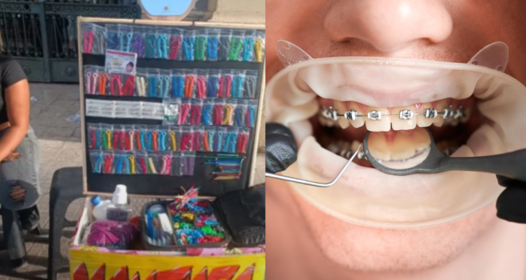 Fotografía del “servicio” dental a las afueras de esatción central (izquierda) y de un procedimiento real de ortodoncia (derecha) en referencia a los “odontólogos ambulantes”