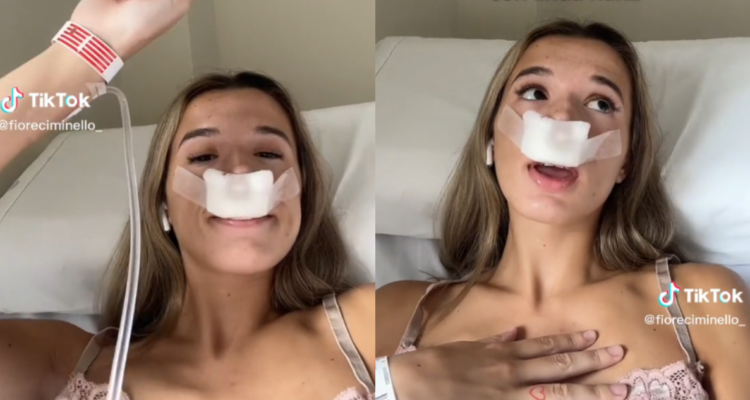 Joven se hace rinoplastía pensando en sus hijos