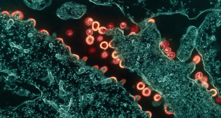 Una imagen contextual del VIH.