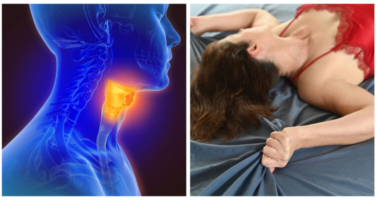 Imagen referencial sobre el vínculo entre el cáncer de garganta y el sexo oral.