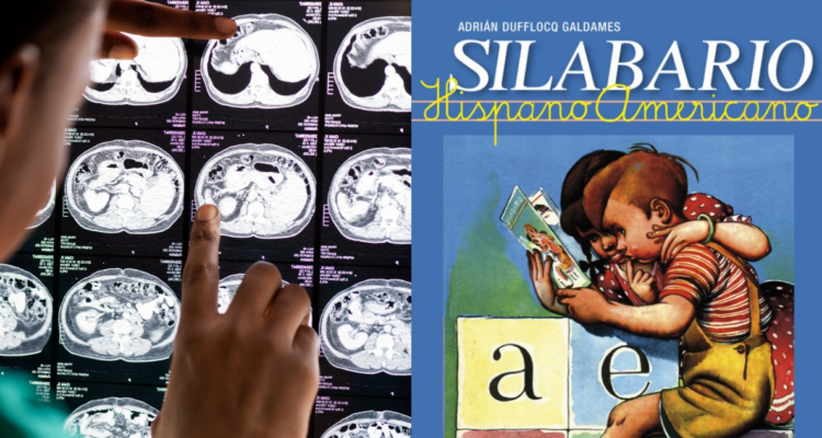 Médico analizando un escanner de cerebro (izquierda) y una fotografía del libro “silabario” en referencia al estudio que señala que el idioma repercute en el funcionamiento del cerebro(derecha)